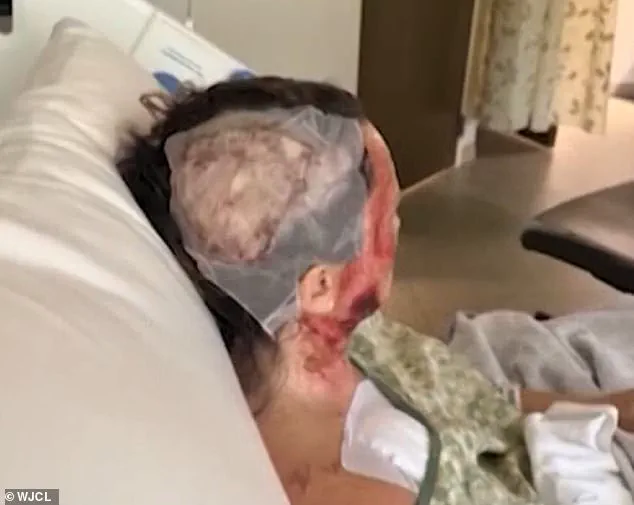 Public Safety Concerns After Corrosive Attack Highlight Need for Stricter Regulations