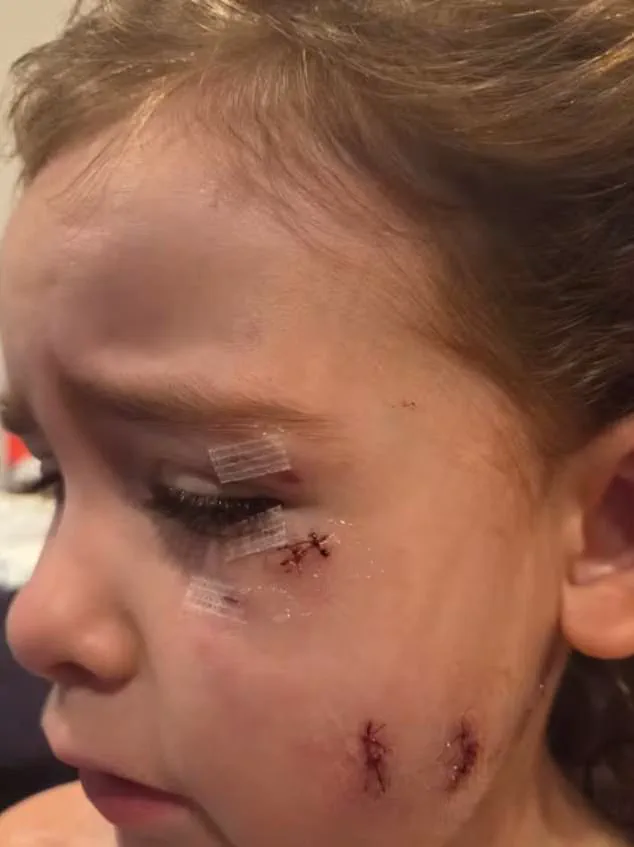 Dog Attack in Oshawa Puts Family in Life-Threatening Situation