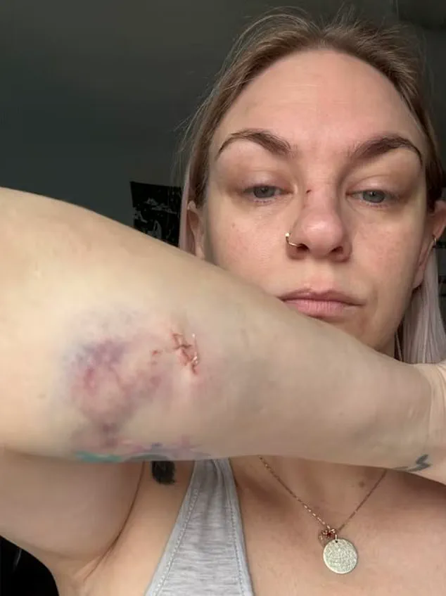 Dog Attack in Oshawa Puts Family in Life-Threatening Situation